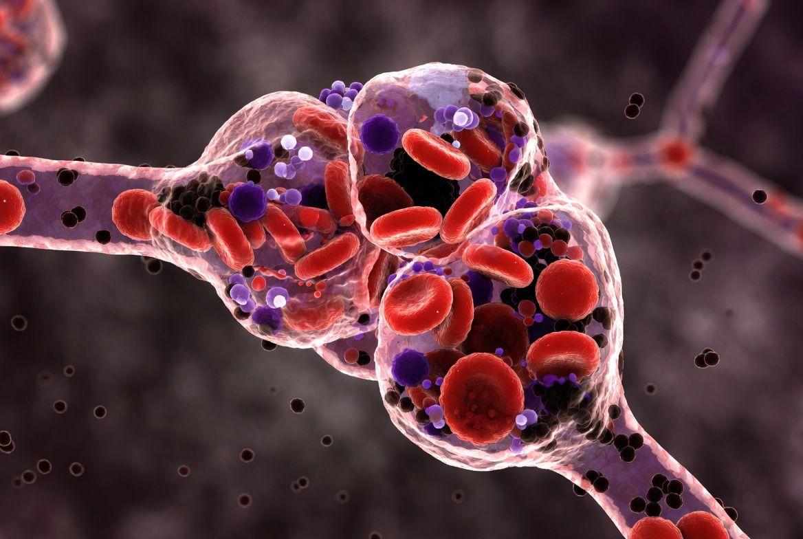 🔍 콩팥을 조용히 파괴하는 소주, 3가지 치명적 경로