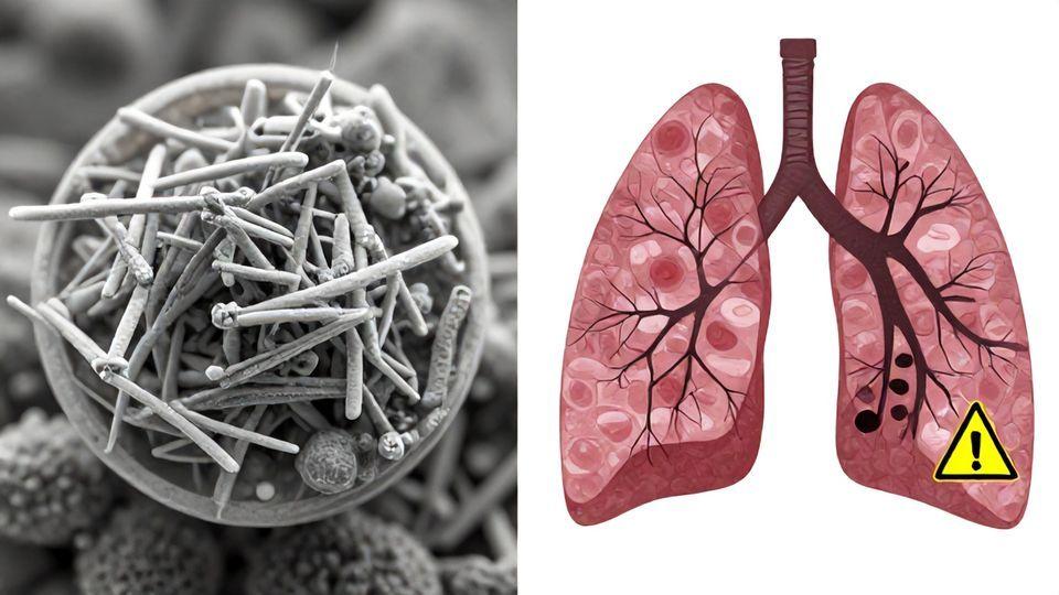 ⚠️ 석면: 조용한 살인자의 위험한 진실
